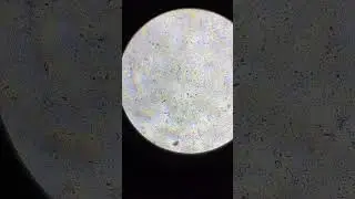 semen analysis microscope examination  #seman #sperm #short