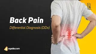 Back Pain Differential Diagnosis | DDx