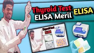 tsthyroid function test -tsh test elisa-thyroid test rlisa- tsh test in hindi #tsh#thyroid