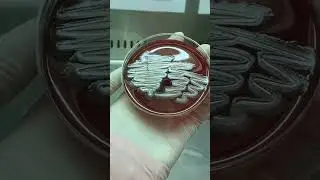 Pseudomonas aeruginosa isolate on Blood agar plate #shorts