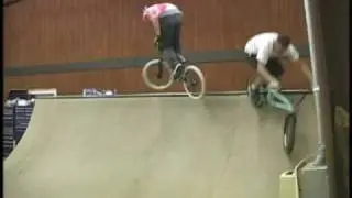 Front Brake Magic