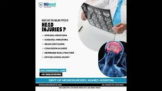 WHAT ARE THE MAJOR TYPES OF HEAD INJURIES ?