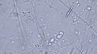 Nematocyst discharge