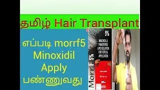 How to Apply morrf 5 Minoxidil & Finasteride/-Tamil Hair Transplant