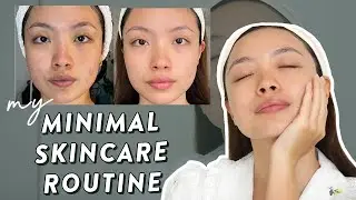 Skincare Calming Buat yang Kulitnya Sensitive & Iritasi, Jerawat juga Sembuh!