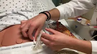 Stoma Site Cleaning and Dressing Change: Discharge Tubefeeding Education