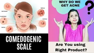 Comedogenic Scale I Why do we get Acne? I Pore clogging I Are you using right Product on your Skin?