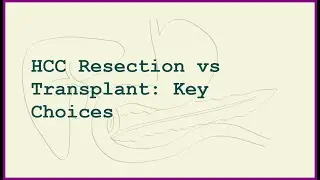 HCC Surgery: Resection vs Liver Transplant