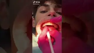 vampire tooth kylethomas #shorts