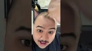 Day 58 penggunaan sanbe hair dan follicore herbal #botak #minoxidil #haircare #ketombe