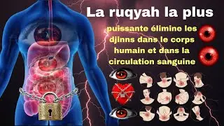La ruqyah la plus puissante élimine les djinns dans le corps humain et dans la circulation sanguine