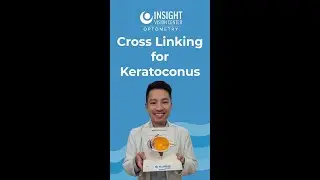 Corneal Cross Linking Halts Keratoconus and Preserves Your Good Sight