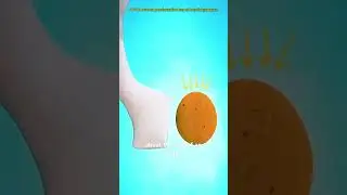 Gastric Bypass Surgery (3D Animation) #drone #theflash #space #automobile #scifi #lyrics #music