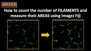 Как подсчитать количество нитей и измерить их ПЛОЩАДЬ с помощью ImageJ Fiji