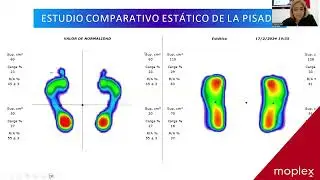 Capacitaci&oacute;n moplex