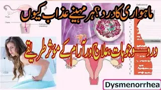 Stop Period Pain Naturally | قدرتی علاج سے آرام پائیں