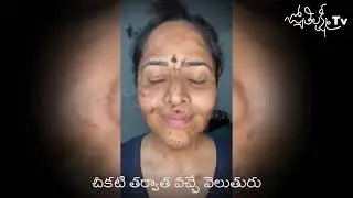Jabardasth anchor anusuya bhardwaj face without makeup full of pimples