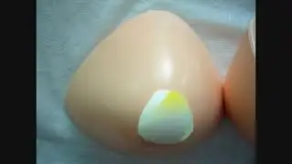 Light Weight Breast Prosthesis for Mastectomy