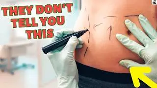 The Hidden Dangers of Body Enhancement: What You Need to Know