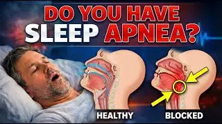 Always Tired or Snoring? This Might Be Sleep Apnea