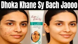 Fair & Lovely Anti Marks Cream Full Review in Urdu | Fade Acne Marks Fast?