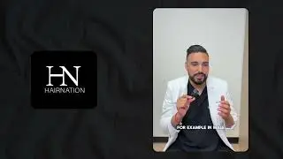Hair Loss Caused By Genetics