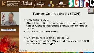Practical Approach to Uterine Sarcomas by Prof  Joseph Carlson