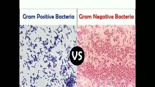 1.3 Gram Positive Bacteria vs Gram Negative Bacteria #MLTLectures