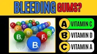 🍊 Can You Recognize Signs of Vitamin Deficiency? | 30-Question Health Quiz