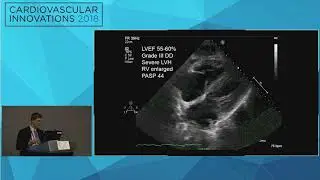 CVI2018 Session: If you hear hoofbeats, think of horses, but remember deadly zebras