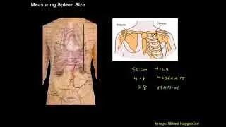 Measuring Spleen Size - Clinical Skills Made Easy