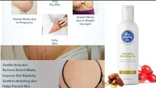 The Moms co Natural Stretch Oil Review and Demo | Best Stretch Marks Oil | GlamUP | Best Stretch Oil