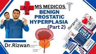 BPH Part 2: Investigations and Treatment for Benign Prostatic Hyperplasia | Enlarged Prostate Guide