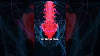 Paralyzed Man Walks Again With AI Assistance - Gert-Jan Oskam's Incredible Story