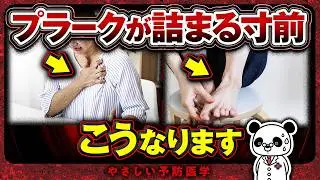 【医師解説】血栓が詰まる直前にだけ出る危険サイン（プラーク　血栓）
