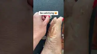 How to Get Rid of Cracked Heels and Calluses with the Plantifique Foot Peel Mask for Baby Soft Feet