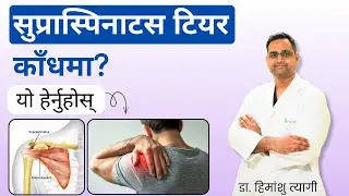 सुप्रास्पिनाटस टियर काँधमा? यो हेर्नुहोस् | Supraspinatus Tear in shoulder? in Nepali