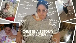 Christina's Story: Beauty in the Scars | Episode 1: Why I'm Telling This Now