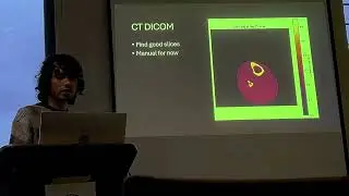 From Scan to Screen: Visualizing Medical DICOM Data with Python