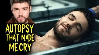 The Autopsy of Liam Payne | The Truth Behind His Last 24 Hours