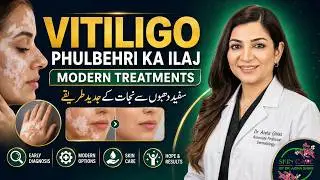 Vitiligo (Phulbehri) Ka Ilaj | Modern Treatments Explained by Dr. Aisha Ghias | پھلبہری کا جدید علاج