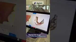 Top Dental Technology with Aleriom  #affordabledentalcare #smilerevolution