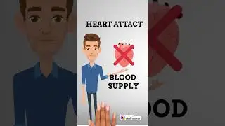 Understanding How Heart Attacks Occur: Causes, Symptoms, and Prevention #MaxWorld