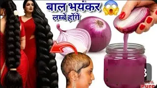 💯DIY Onion Oil for Extreme Hairgrowth/कसम से बस 1 बार लगा कर देखो बाल 20 गुना तेजी से बढ़ेंगे 😱