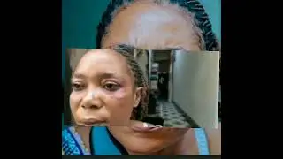 Aliyeandamana kwenda Ofisi za Ubalozi wa Papa akiri kujeruhiwa na  watu wasio julikana 