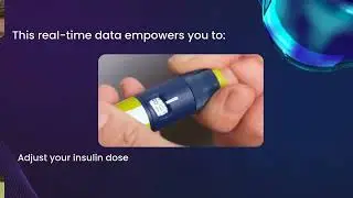 Continuous Glucose Monitoring (CGM) offers a convenient way to manage diabetes. A tiny sensor mea...