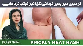 Prickly Heat Rash in Children &ndash; What Should You Do?