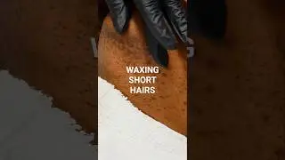 Can This Wax Grab Short Hairs? #Hirsutism #FaceWax #ChinWax