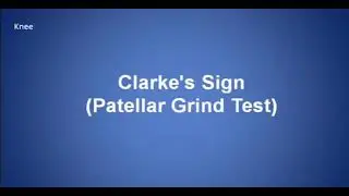 Clarke's Sigh Patellar grind test