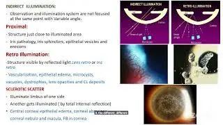 VIBRANT CLASS Via respected Kapil Gautam sir |B.Optometry|